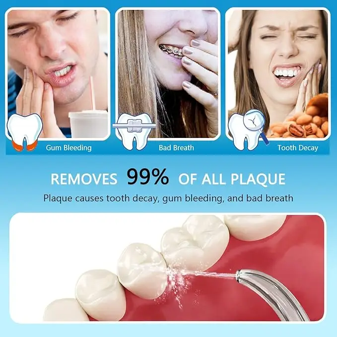 Apiker Dental Water Flosser for Teeth and Braces with 8 Multifunctional Tips, 600ml Capacity Electric Oral Irrigator with 10 Water Pressure Settings for Family - Image 7